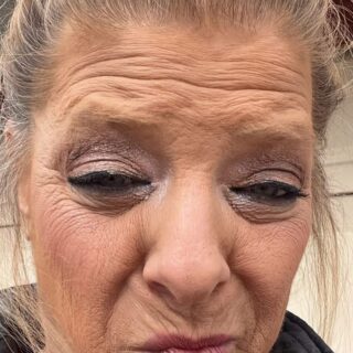 What an amazing transformation! With permission, this patient has allowed me to share her results from her Xeomin injections to the forehead, crows feet and around the mouth as well as the dermal filler applied to her nasal-labial folds, marionette lines and lips. She was bothered by “not having an upper lip” and “smokers lines” around her mouth. We’ve done two treatments and she is absolutely thrilled with her results! Schedule your appointment today!! @revitalizing_yourhealth !!!!